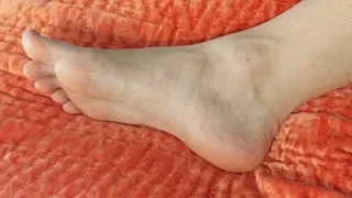 Visible Pulse in my Foot and Ankle -- Posterior Tibial Artery