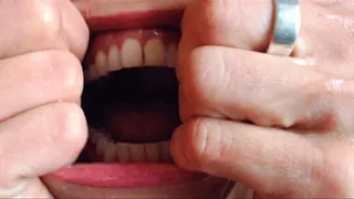 Mouth Stretched WIDE