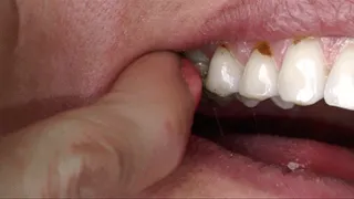 Dental Emergency!