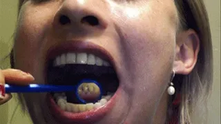 2015 Mouth Examination