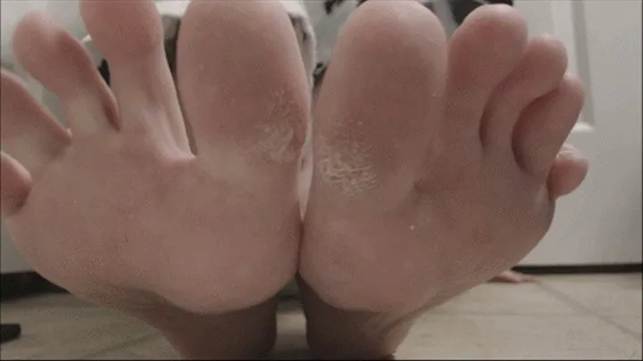 Toe Callus Sanding