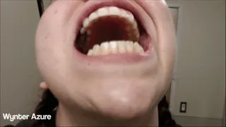 Post Cleaning Mouth Tour (ID # 1570 HD )