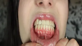 The Veins In My Mouth