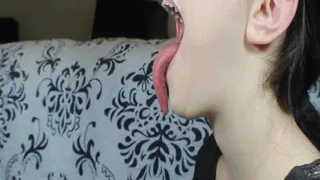 Side Of My Tongue 2