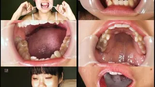 Extreme Mouth Pulling Ends in Toothbrushing! - Part 2