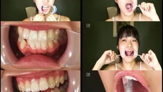 Extreme Mouth Pulling Ends in Toothbrushing!