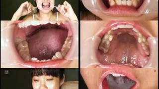 Extreme Mouth Pulling Ends in Toothbrushing! - Part 2 (Faster Download)