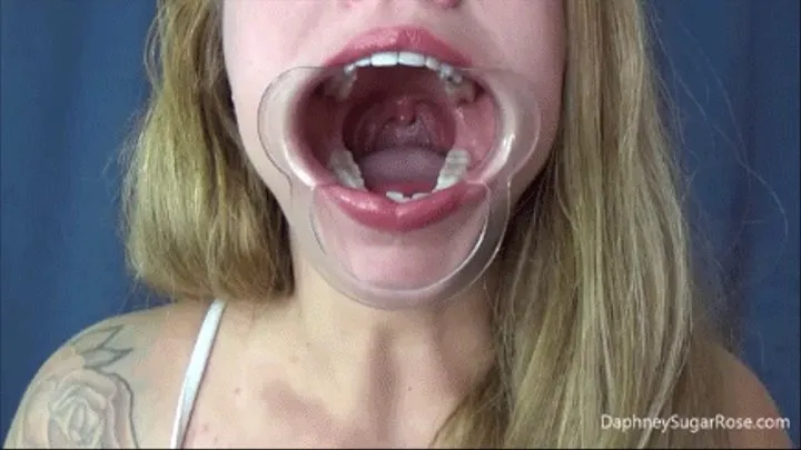 Cheek Retractor Spreading My Mouth Open Wide