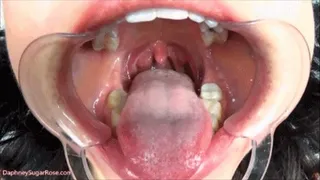 Cheek Retractor Tongue Tease