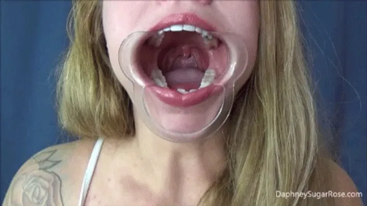 Cheek Retractor Spreading My Mouth Open Wide