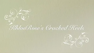 KhloeRose's Cracked Heels