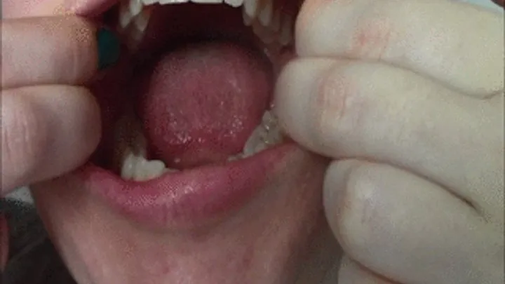 Inside my mouth 2