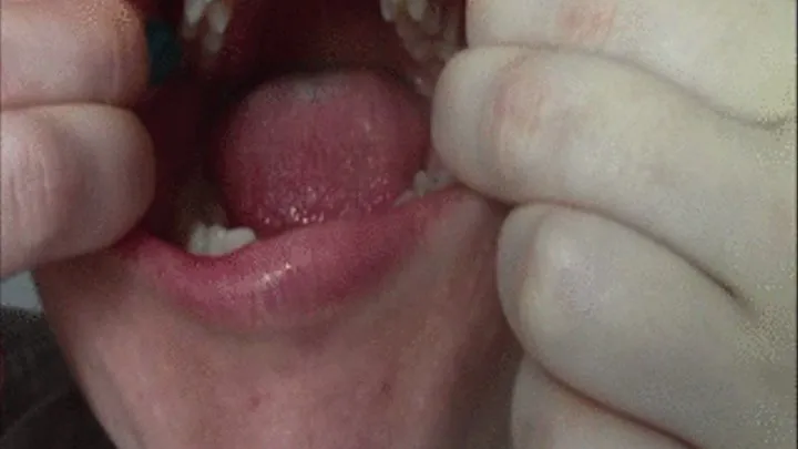 Inside my mouth 2