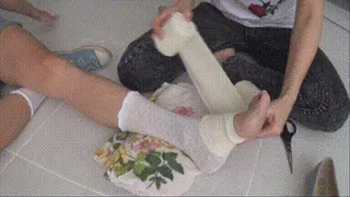 My broken leg and masturbation with bandaging JII
