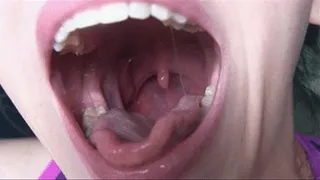 Uvulva Focus - Coughing, Gagging and Wide Open Mouth View