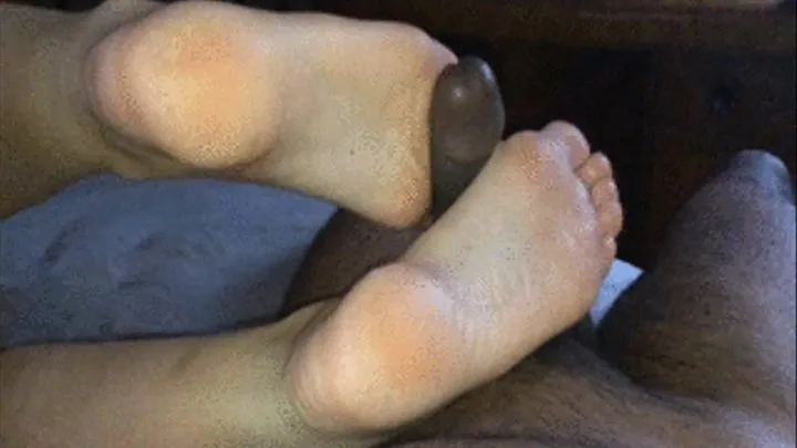 Arched Soles Cause Cock Eruption