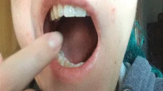 Tongue, Throat, Tonsils and Teeth