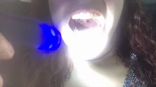 Mouth torch light