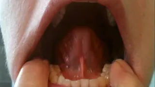 finger in mouth 2°
