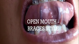 OPEN MOUTH - BRACES STYLE