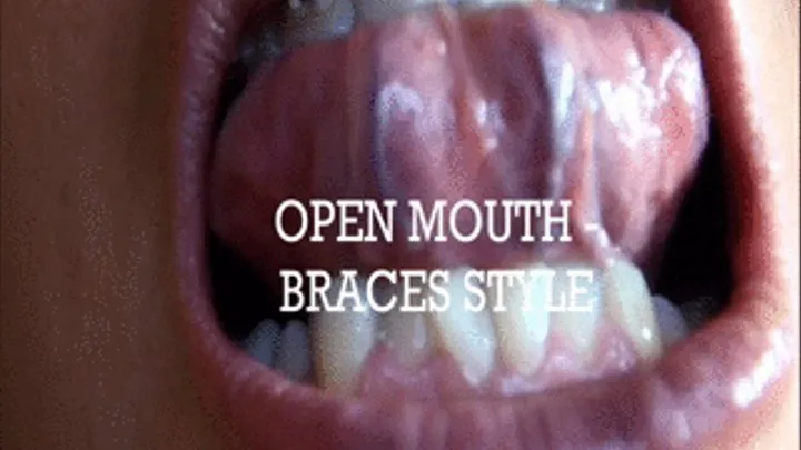 OPEN MOUTH - BRACES STYLE - full 1920x1080