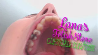 Full Mouth & Teeth Exam