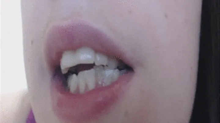 Mouth Fetish What Dental Work I need Done Really Bad