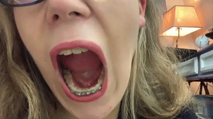 Licking & Tasting My Teeth and Braces( Mouth Showoff)