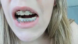 Tour Of My Braces & Mouth Updated Mouth Fetish