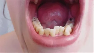 Dental Work Exam