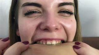 Klara's Braces First Time Bite