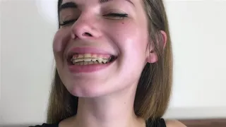 Klara's Braces For First Time