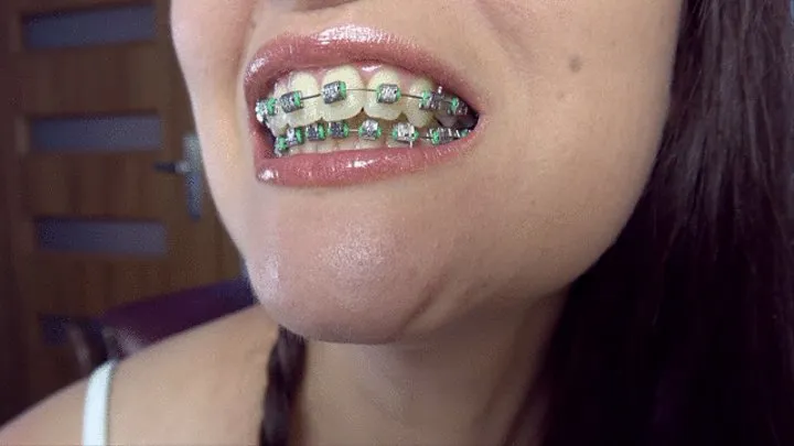 Weronika - Braces - Green Rubbers - Extreme Close-ups