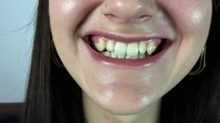 Brunette Teeth Show