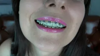 JOI - Weronika - Cum On My Braces