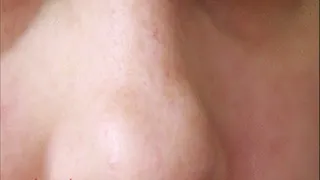 NEW FRECKLE AFTER HAVING BABY