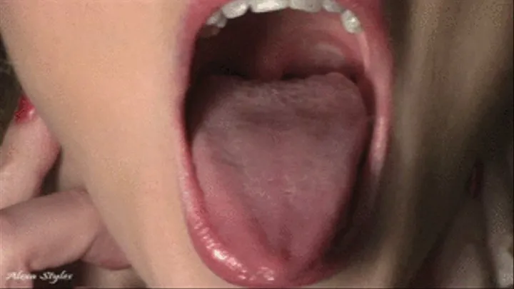 Blonde Alexa Displays Her Beautiful Fillings/Caps/Teeth