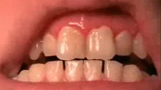 Ouch my Swollen Gums Ouch