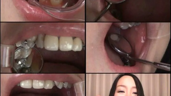 Sweetheart Gets her Mouth Stretched Open During Dental Checkup! - Part 3 - LIA-213