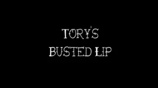 Tory's Busted Lip