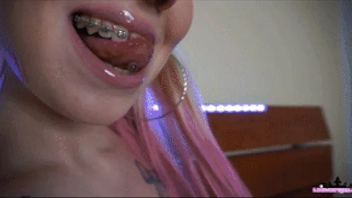 Brat Girl With Braces!