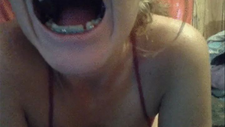 braces and mouth