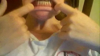 dental rant 3