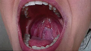 wide larynx, tonsils, tongue, sharp teeth