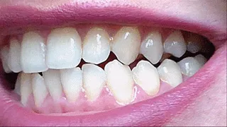 tongue between teeth