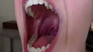 chew monsters, sharp fangs bite their soft body,*