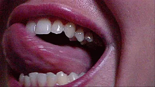teeth miss