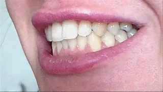 teeth mouth
