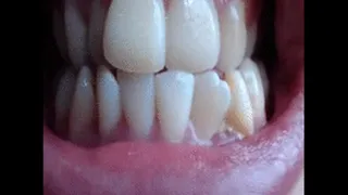 Mouth closeup