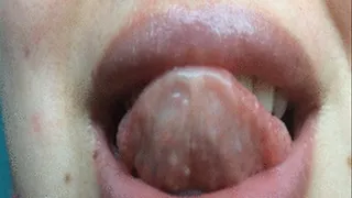 Look inside my mouth